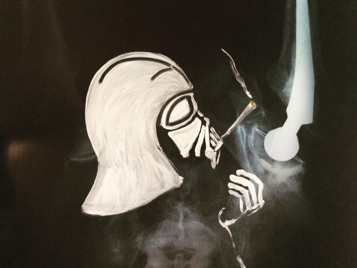 The Darth Side 2018 Oil On Xray