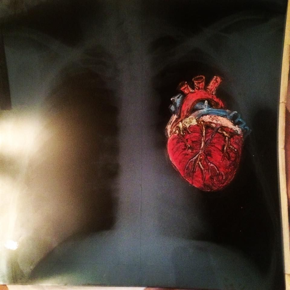 The Tin Man Oil On Xray 2018