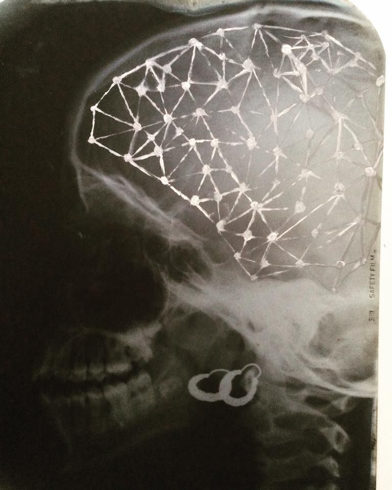 A New Yorkers Mind Oil On Xray 2018