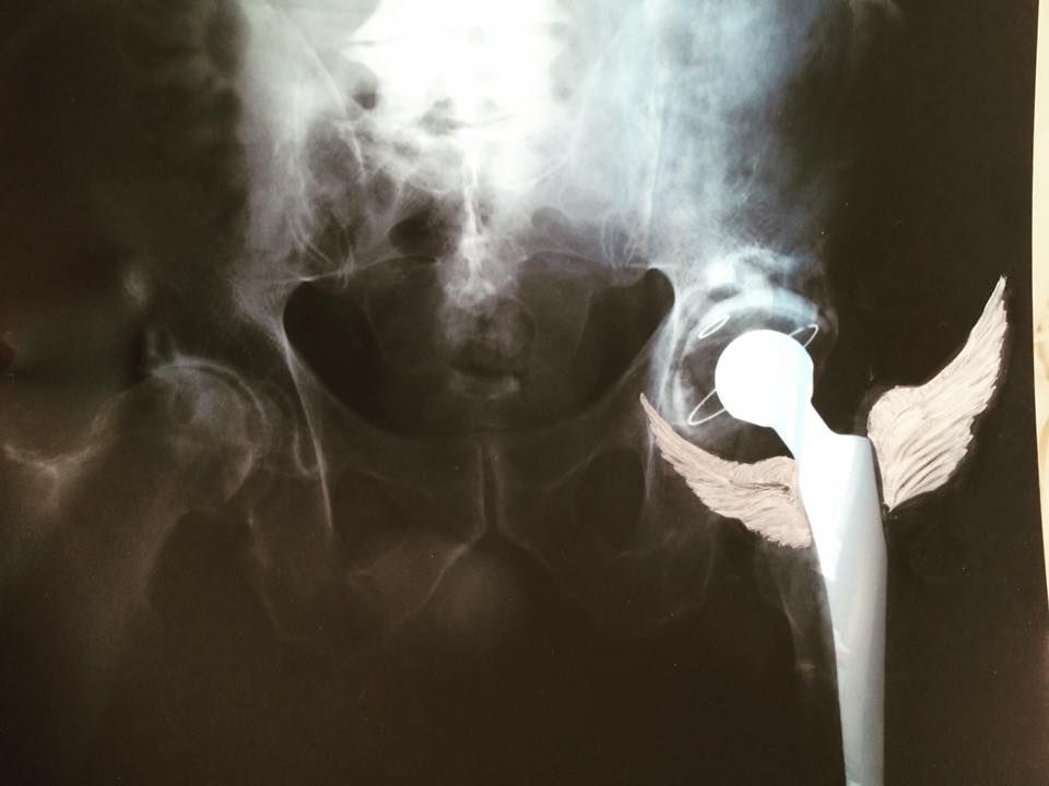 An Angel Saved My Leg Oil On Xray 2018