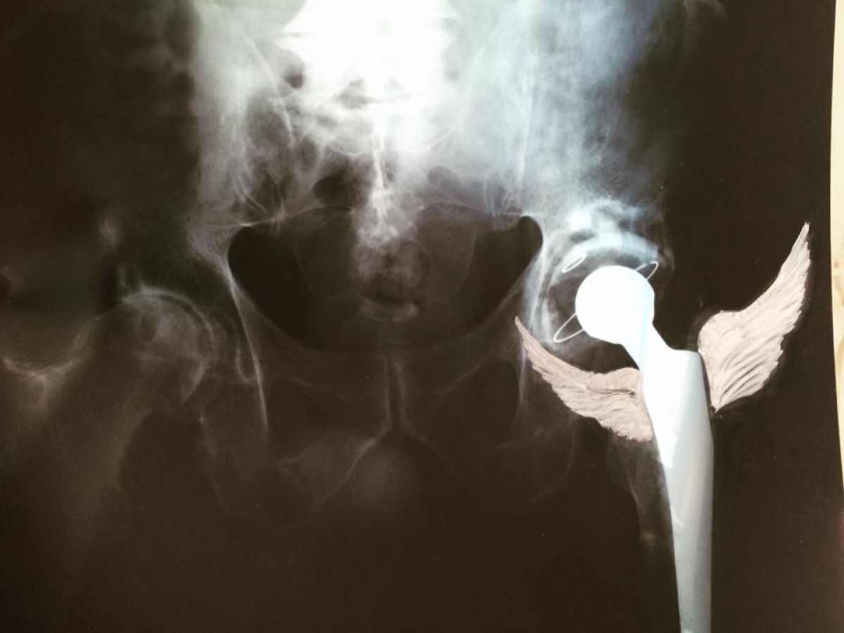 An Angel Saved My Leg Oil On Xray 2018